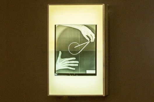 Negatoscópio com lâmina de raio X com mãos e compasso, peça da exposição “Melancolia 3”, de Marco do Valle<br />Foto divulgação 